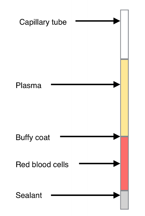 Pcv on sale in blood